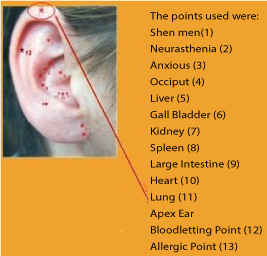 Can We Treat Atopic Dermatitis without using Corticosteroids?